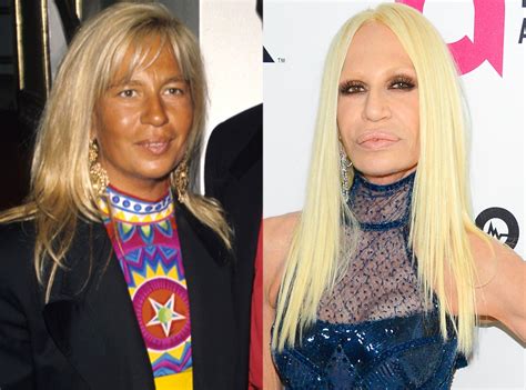 donatella versace difficoltà|donatella versace before and after.